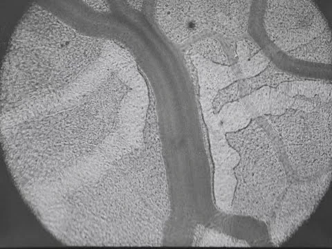 Blood Circulation Seen Thru Microscope Of Chamber In Rabbit's Ear ...