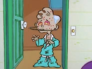 Jimmy with chickenpox.