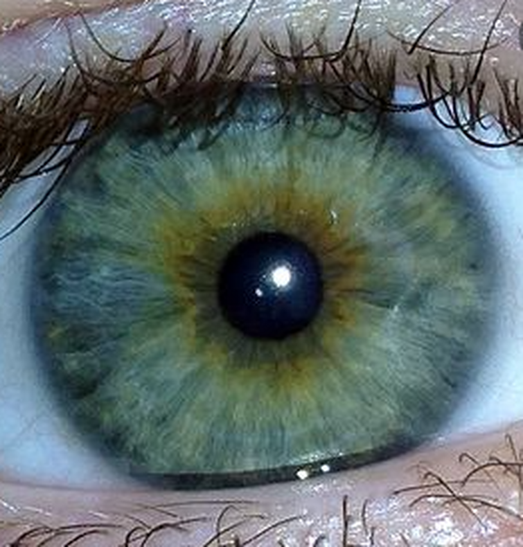 Зелено голубо желтые глаза. Центральная гетерохромия хамелеон. Болотный цвет глаз гетерохромия. Центральная гетерохромия карих глаз. Центральная гетерохромия глаз Карий и зеленый.