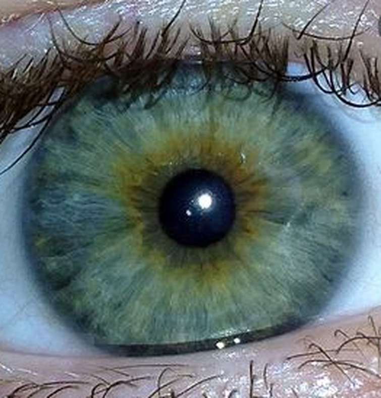 I have blue eyes. Центральная гетерохромия хамелеон. Болотный цвет глаз гетерохромия. Центральная гетерохромия карих глаз. Центральная гетерохромия глаз Карий и зеленый.