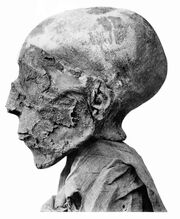 Seti II Mummy