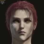 Millicent's face after inserting the needle