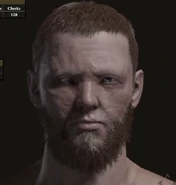 Adan, Thief of Fire's burned face; his right eye is blinded