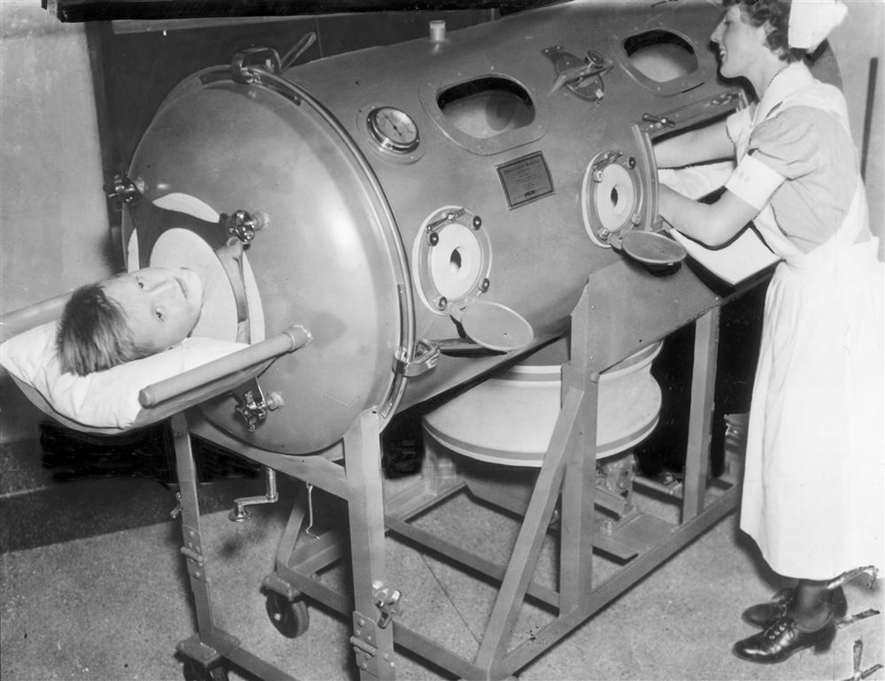 polio breathing machine