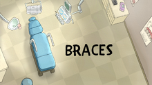 Braces