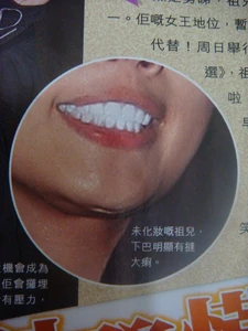 20081221 joey face lift