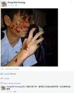 馮煒光亦在facebook轉載有關照片，並留言稱：「任何人用暴力都不對，警唄（員）因工受傷也值得同情。民主精神包括關愛。」