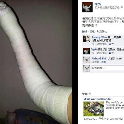 網上流傳曾有人因被水貨客撞到而斷手