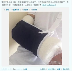 「這次不是拍戲化妝⋯ 而是真真正正的受傷了。昨天拍劇時因不小心把右手跌斷了。現住院中！等一下便會做手術。大家放心！我還好！」[5]