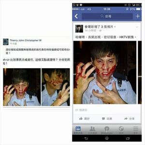 Occupycentral wound&hktv.jpg (58 KB) 有網民聲稱照片為警員在衝突中遭毒手施襲(左),但隨即被發現是拍劇時的花絮照(右)