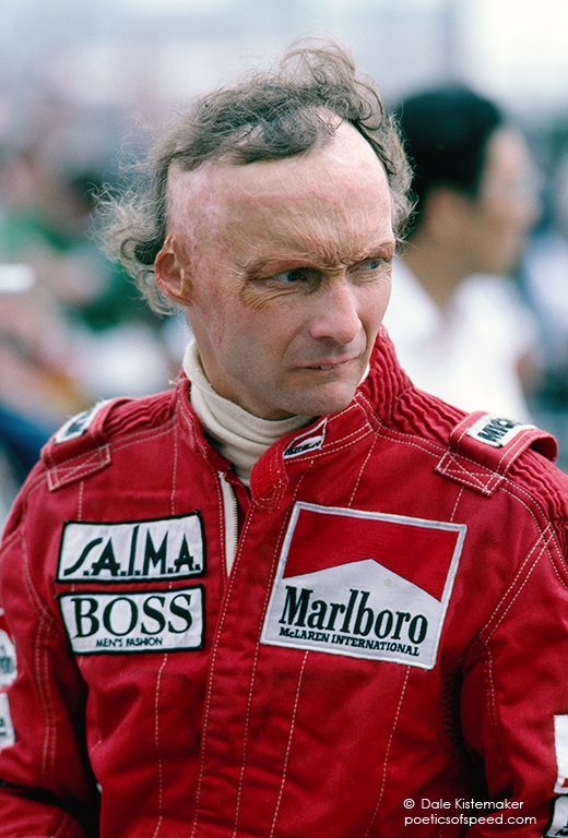 niki lauda burn helmet