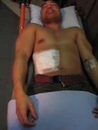 Edwin suffering from dehydration and a gunshot wound.