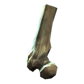 Broken femur