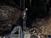 Das Skelett von Mr. Herzog