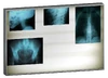 X-Ray lightbox