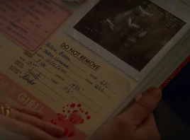 Peters baby sonogram