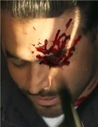 Vazquez.jpg (57 KB) Vazquez after been stabbed by Daniel to prevent reanimation