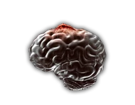 Etapa2NeuraxWorm.png (82 kB) Etapa 2