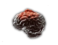 Etapa3NeuraxWorm.png (103 kB) Etapa 3