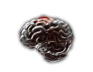 Etapa1NeuraxWorm.png (91 kB) Etapa 1