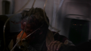 Dustin burned.png