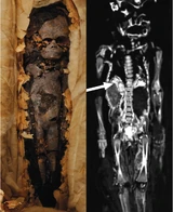mummy found in Tutankhamun's tomb, labelled as a fetus based on bone length 