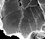 Edmonto teeth electronscanning