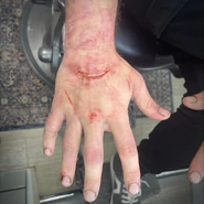 FNaFFilm JoshInMikeMakeup2.jpg (141 KB) Ditto, bruised hand.