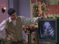 Carrol's Sonongram.jpg