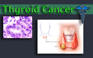 Thyroidsa