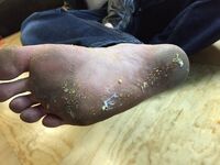Arin foot stream