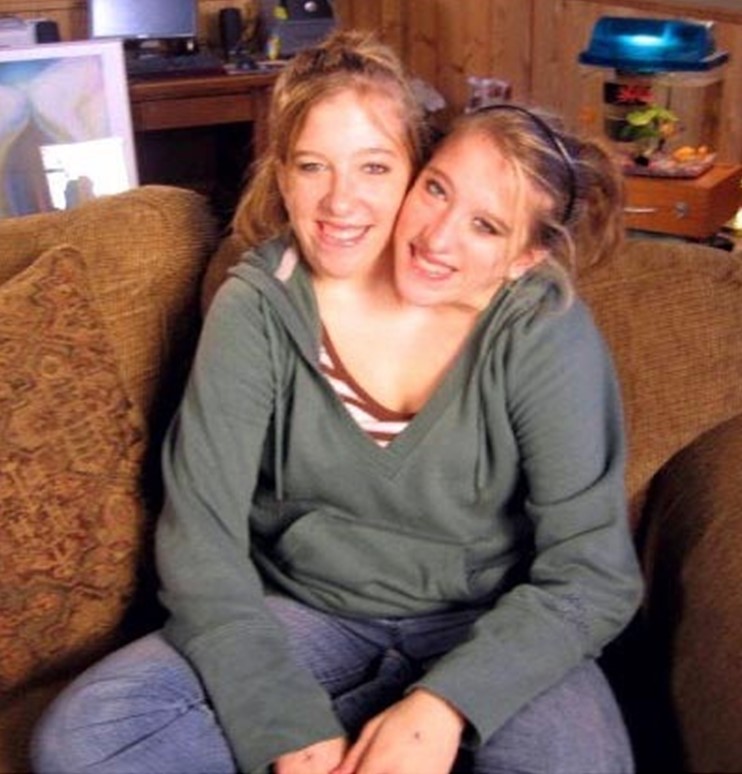 abby and brittany hensel photos