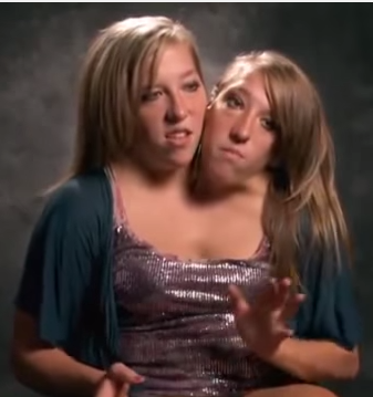 Conjoined twins Abby and Brittany Hensel explain how they drive a car