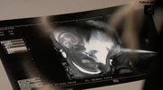 BGC Ultrasound 2025