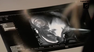 Ultrasound Photo (2025)