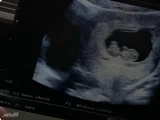 Baby Robinson