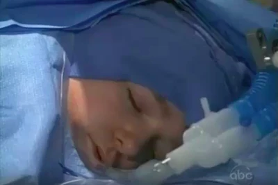 Michael has surgery