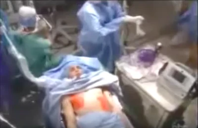 Michael has surgery again