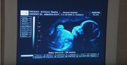 BabyGilmoreCorbin Sonogram