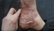 GSHunter-fuß-fällt-ab-NSFL.jpg (83 KB) GS Hunters hands and feet