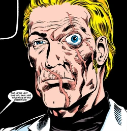 Snake Eyes Disfigurement