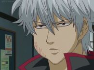 Gintoki with a toothache in Episode 175