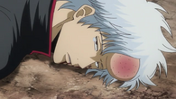 Gintoki with a bump on his forehead in Episode 325