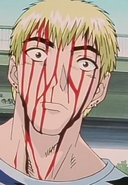 Bloodied Onizuka