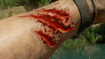 Lacerationclose ups