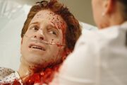 Nick Hanscom has had a large tumor removed from his neck