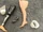 Prosthesis