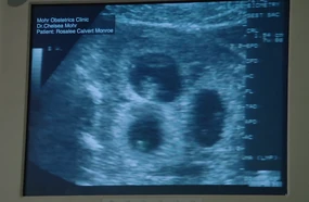 605-Triplets ultrasound