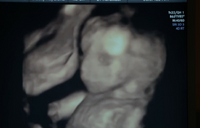 305-Adalind's ultrasound