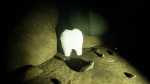 Milk Molar Undershed2